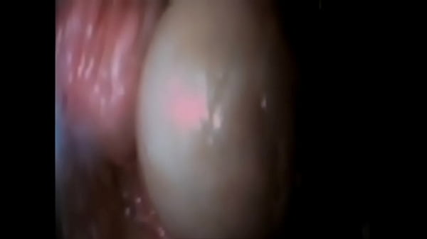Slutty milf  anal in Nylons