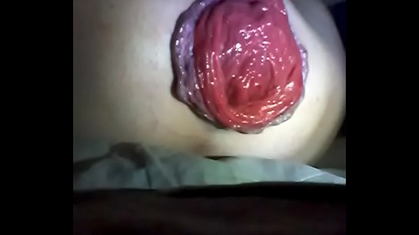 Ass gape