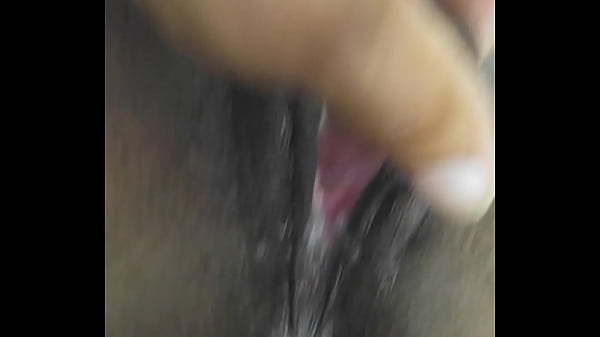 DP 2