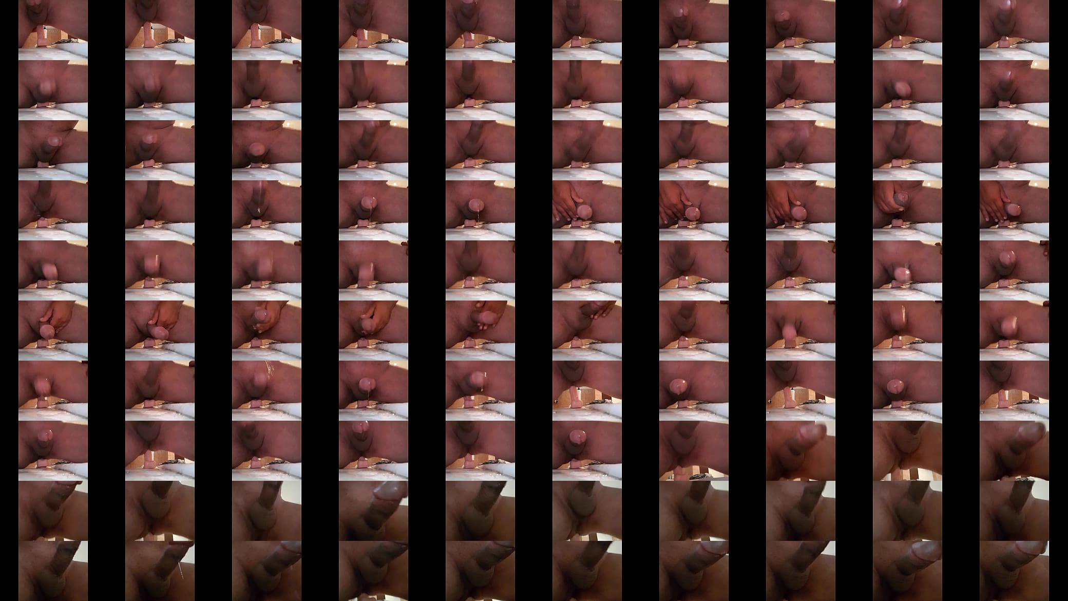 Anal frontal 预览图