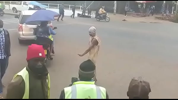 Circumcision man part 1