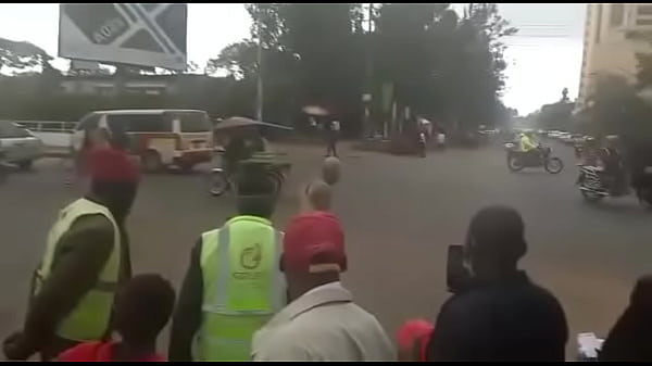 Circumcision man part 1