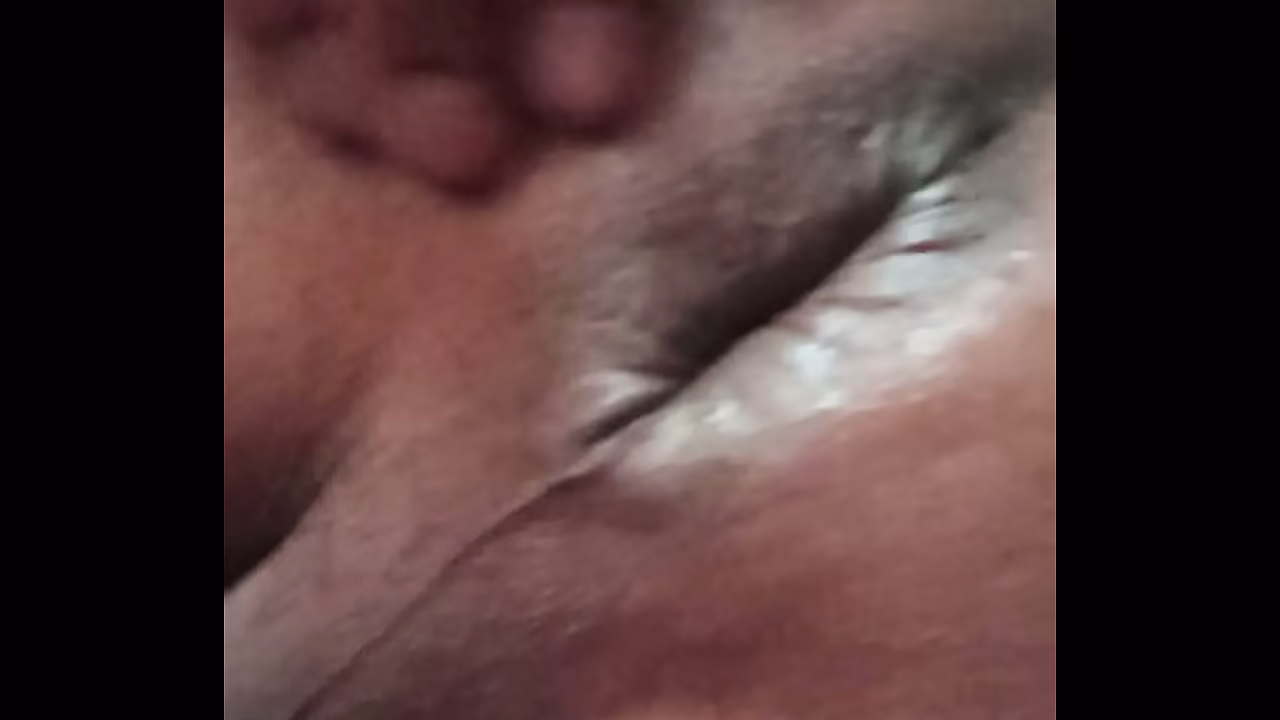 Tes&atilde_o de Cuceta gigante...