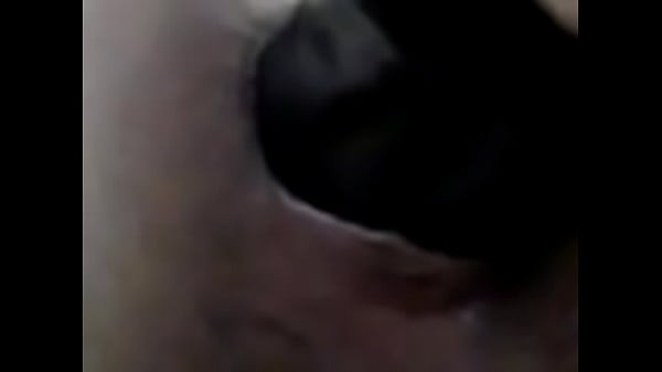 Anal dilatation