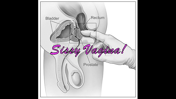 Sissy diagnosis perfect